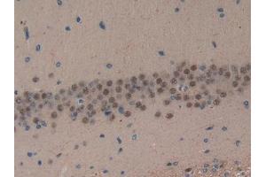 Immunohistochemistry (IHC) image for anti-Mitochondrially Encoded NADH Dehydrogenase 5 (MT-ND5) (AA 425-562) antibody (ABIN7437398)
