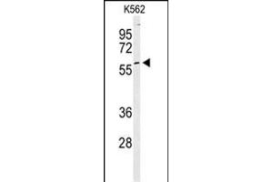 Western blot analysis of PKM2 Antibody (C-term ) (ABIN6242815 and ABIN6578981) in K562 cell line lysates (35 μg/lane). (PKM2 抗体  (C-Term))