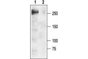 Western blot analysis of rat brain membranes: - 1. (SCN1A 抗体  (Intracellular))