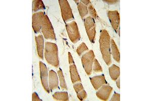 Forlin-fixed and paraffin-embedded hun skeletal muscle reacted with SD4 Antibody (C-term), which was peroxidase-conjugated to the secondary antibody, followed by DAB staining. (SMAD4 抗体  (C-Term))