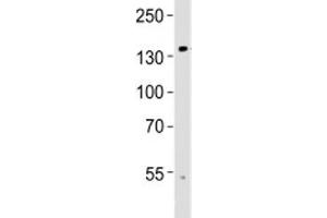 Western blot analysis of lysate from human brain tissue using TRPM8 antibody at 1:1000. (TRPM8 抗体  (AA 521-552))