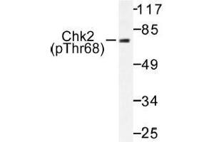 Image no. 1 for anti-Checkpoint Kinase 2 (CHEK2) (pThr68) antibody (ABIN317991) (CHEK2 抗体  (pThr68))