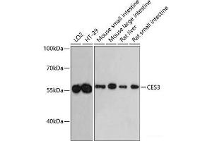 Western blot analysis of extracts of various cell lines using CES3 Polyclonal Antibody at dilution of 1:3000. (CES3 抗体)