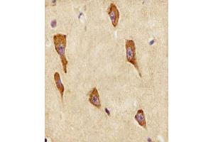(ABIN6243817 and ABIN6578505) staining GNG12 in human brain tissue sections by Immunohistochemistry (IHC-P - paraformaldehyde-fixed, paraffin-embedded sections). (GNG12 抗体  (AA 37-68))
