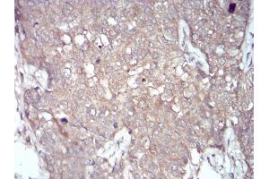 Immunohistochemistry (IHC) image for anti-NADPH Oxidase 4 (NOX4) (AA 210-310) antibody (ABIN5872374) (NADPH Oxidase 4 抗体  (AA 210-310))