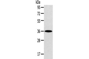 Western Blotting (WB) image for anti-Homeobox D13 (HOXD13) antibody (ABIN5961464) (Homeobox D13 抗体)