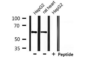 Western blot analysis of extracts from HepG2 and rat heart, using CLCC1 Antibody. (CLCC1 抗体  (Internal Region))