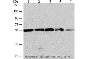 Western blot analysis of A375, 293T cell and mouse liver tissue, Jurkat cell and human fetal kidney tissue, using NAMPT Polyclonal Antibody at dilution of 1:700 (NAMPT 抗体)