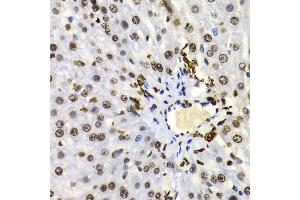 Immunohistochemistry (IHC) image for anti-Histone 3 (H3) (H3K4me) antibody (ABIN3023251)