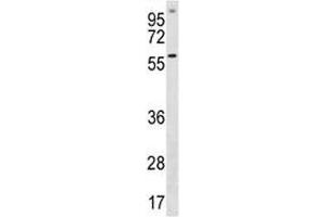 ETV5 antibody western blot analysis in A549 lysate (ETV5 抗体  (AA 8-37))