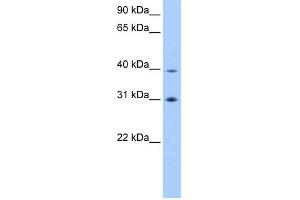 WB Suggested Anti-EIF3H Antibody Titration:  0.