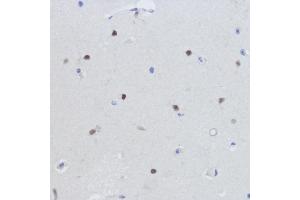 Immunohistochemistry (IHC) image for anti-Estrogen-Related Receptor alpha (ESRRA) (AA 1-423) antibody (ABIN6140306)