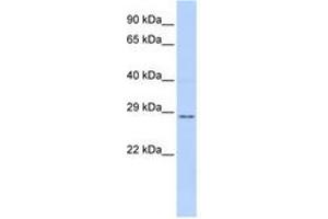Image no. 1 for anti-Tissue Factor Pathway Inhibitor 2 (TFPI2) (AA 72-121) antibody (ABIN6741435) (TFPI2 抗体  (AA 72-121))