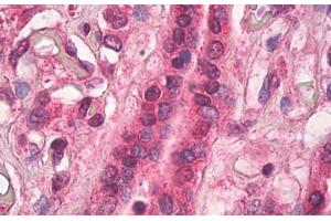 Human Placenta: Formalin-Fixed, Paraffin-Embedded (FFPE) (TGM1 抗体)