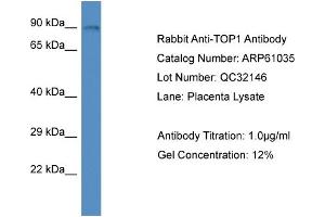 Western Blotting (WB) image for anti-Topoisomerase (DNA) I (TOP1) (N-Term) antibody (ABIN2788658) (Topoisomerase I 抗体  (N-Term))