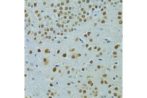 Immunohistochemistry of paraffin-embedded mouse brain using MUS81 antibody (ABIN6132372, ABIN6144202, ABIN6144203 and ABIN6222560) at dilution of 1:100 (40x lens). (MUS81 抗体  (AA 1-350))