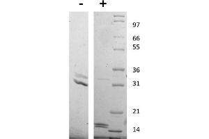 SDS-PAGE of Human Interleukin-17AF Heterodimer Recombinant Protein SDS-PAGE of Human Interleukin-17 Animal Free Recombinant Protein. (IL-17A/F 蛋白)