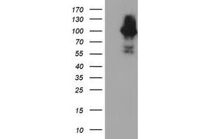 HEK293T cells were transfected with the pCMV6-ENTRY control (Left lane) or pCMV6-ENTRY C1S (Right lane) cDNA for 48 hrs and lysed. (C1S 抗体)