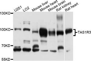 Western blot analysis of extracts of various cells, using TAS1R3 antibody. (TAS1R3 抗体)