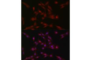 Immunofluorescence analysis of PC-12 cells using SOCS1 Rabbit pAb (ABIN6128737, ABIN6148263, ABIN6148266 and ABIN6223700) at dilution of 1:100 (40x lens).