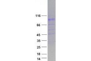 Western Blotting (WB) image for Solute Carrier Family 26, Member 4 (SLC26A4) protein (Myc-DYKDDDDK Tag) (ABIN2732167)