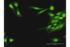 Immunofluorescence of purified MaxPab antibody to PLA2G16 on HeLa cell. (PLA2G16 抗体  (AA 1-162))