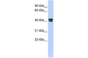Western Blotting (WB) image for anti-Calcium Channel, Voltage-Dependent, beta 3 Subunit (CACNB3) antibody (ABIN2458122) (CACNB3 抗体)