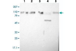 Western blot analysis of Lane 1: RT-4, Lane 2: EFO-21, Lane 3: A-431, Lane 4: Liver, Lane 5: Tonsil with SMEK2 polyclonal antibody  at 1:250-1:500 dilution. (SMEK2 抗体)