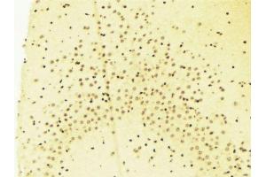 ABIN6269019 at 1/100 staining Mouse brain tissue by IHC-P. (HDAC7 抗体  (C-Term))