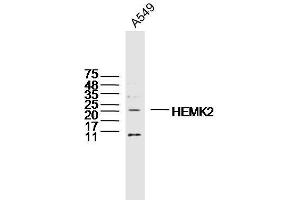 A549 lysates probed with HEMK2 Polyclonal Antibody, Unconjugated  at 1:300 dilution and 4˚C overnight incubation. (N6AMT1 抗体  (AA 1-100))
