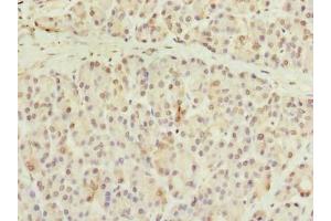 Immunohistochemistry of paraffin-embedded human pancreatic tissue using ABIN7148076 at dilution of 1:100 (CCDC116 抗体  (AA 1-300))