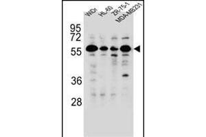 FOXC2 Antibody (Center ) (ABIN655526 and ABIN2845039) western blot analysis in WiDr,HL-60,ZR-75-1,MDA-M cell line lysates (35 μg/lane). (FOXC2 抗体  (AA 183-210))