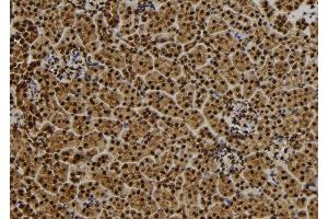 ABIN6279445 at 1/100 staining Mouse kidney tissue by IHC-P. (QSER1 抗体  (Internal Region))