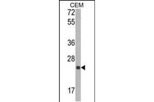 Western blot analysis of TIMP1 Antibody in CEM cell line lysates (35ug/lane) (TIMP1 抗体  (N-Term))