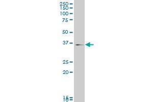 MAPK14 monoclonal antibody (M01), clone 3D5 Western Blot analysis of MAPK14 expression in C32 . (MAPK14 抗体  (AA 260-360))