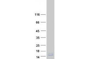 Western Blotting (WB) image for Purkinje Cell Protein 4 (PCP4) protein (Myc-DYKDDDDK Tag) (ABIN2728446)