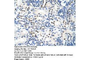 Rabbit Anti-TROVE2 Antibody  Paraffin Embedded Tissue: Human Kidney Cellular Data: Epithelial cells of renal tubule Antibody Concentration: 4. (TROVE2 抗体  (N-Term))