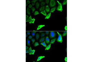 Immunofluorescence analysis of A549 cell using HSP90AA1 antibody. (HSP90AA1 抗体  (AA 433-732))