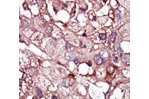 Immunohistochemistry (IHC) image for anti-Activin A Receptor Type II-Like 1 (ACVRL1) (AA 38-68) antibody (ABIN3029853)