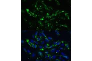 Immunofluorescence analysis of U2OS cells using CGRP antibody (ABIN6128310, ABIN6137852, ABIN6137855 and ABIN6221187) at dilution of 1:100. (CGRP 抗体  (AA 1-141))