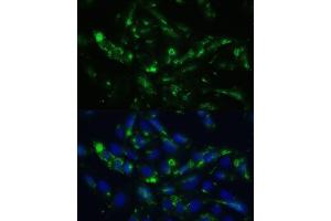 Immunofluorescence analysis of U2OS cells using CGRP antibody (ABIN6128310, ABIN6137852, ABIN6137855 and ABIN6221187) at dilution of 1:100. (CGRP 抗体  (AA 1-141))