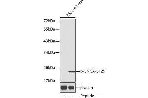 Western blot analysis of extracts from Mouse brain tissue using Phospho-SNCA(S129) Polyclonal Antibody. (SNCA 抗体  (pSer129))