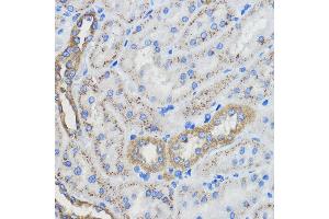 Immunohistochemistry (IHC) image for anti-Cytochrome P450, Family 51, Subfamily A, Polypeptide 1 (CYP51A1) (AA 210-509) antibody (ABIN6139370)