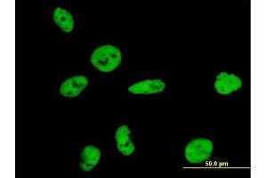 Immunofluorescence of purified MaxPab antibody to NUMA1 on HeLa cell. (NUMA1 抗体  (AA 1-1193))