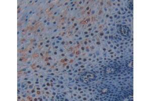 IHC-P analysis of esophagus tissue, with DAB staining. (TRERF1 抗体  (AA 779-936))