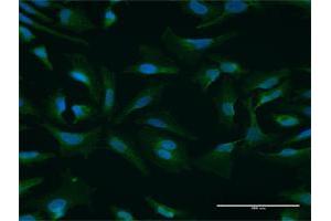 Immunofluorescence of purified MaxPab antibody to NUFIP1 on HeLa cell. (NUFIP1 抗体  (AA 1-276))