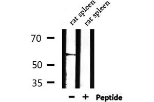 Western blot analysis of extracts from rat brain,mouse brain,rat spleen, using THBD Antibody. (Thrombomodulin 抗体  (C-Term))
