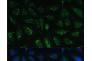 Immunofluorescence analysis of U-2 OS cells using RAPGEF1 Polyclonal Antibody at dilution of 1:100 (40x lens). (GRF2 抗体)