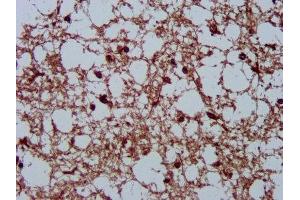 IHC image of ABIN7151663 diluted at 1:200 and staining in paraffin-embedded human brain tissue performed on a Leica BondTM system.