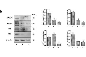 Relative expression of AANAT, HIOMT, MT1, and MT2 in COCs of follicles of different sizes. (AANAT 抗体  (AA 141-207))